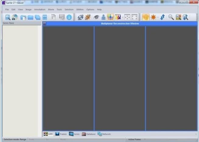 Sante CT Viewer